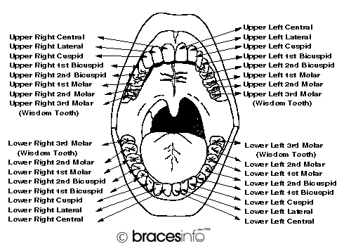 Dental Terms Braces Terminology